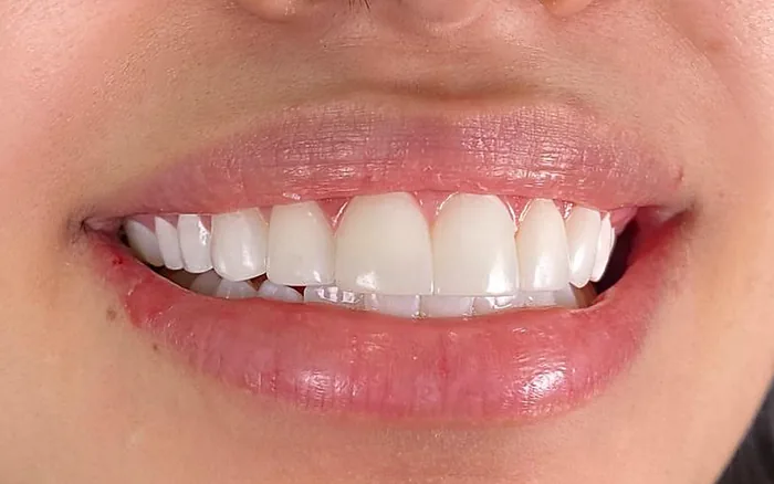 Odontología estética